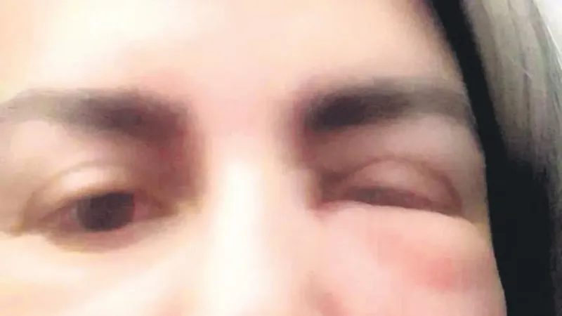 Güzelleşmek için gitti tanınmaz hâle geldi